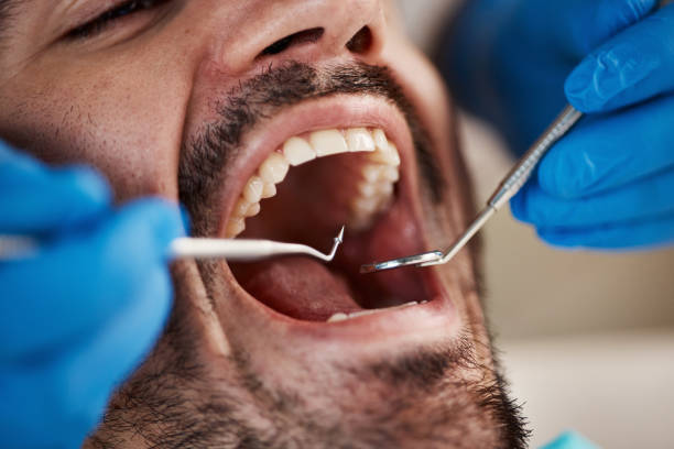 Best Cosmetic Dentistry  in Loyola, CA